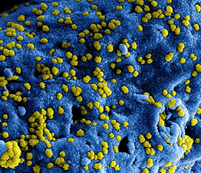 UPDATE: How is the coronavirus (COVID-19) affecting private healthcare marketing?